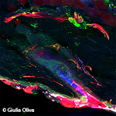 Vignette illustrant cette actualité