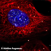 Vignette illustrant cette actualité