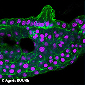 Vignette illustrant cette actualité