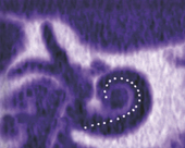 Vignette illustrant cette actualité