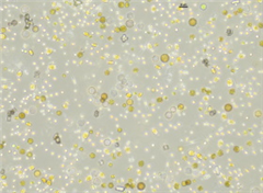 Vignette illustrant cette actualité