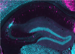 Vignette illustrant cette actualité