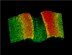Vignette illustrant cette actualité