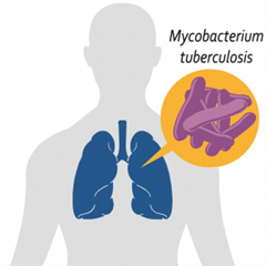 Vignette illustrant cette actualité
