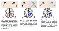 Vignette illustrant cette actualité