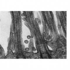 Vignette illustrant cette actualité