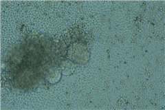 Vignette illustrant cette actualité