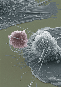 Vignette illustrant cette actualité