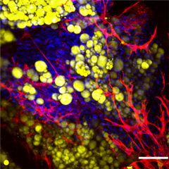Vignette illustrant cette actualité