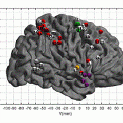 Vignette illustrant cette actualité