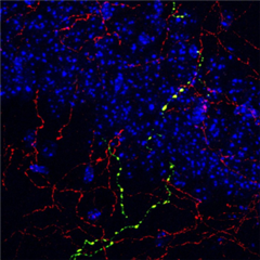 Vignette illustrant cette actualité