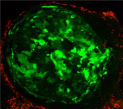 Vignette illustrant cette actualité