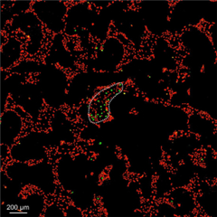 Vignette illustrant cette actualité