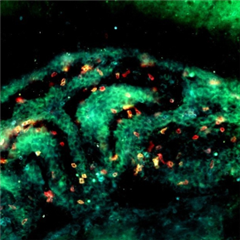 Vignette illustrant cette actualité