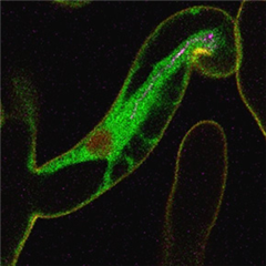 Vignette illustrant cette actualité