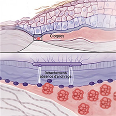 Vignette illustrant cette actualité