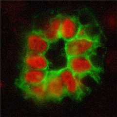 Vignette illustrant cette actualité