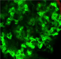 Vignette illustrant cette actualité