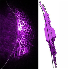 Vignette illustrant cette actualité