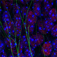 Vignette illustrant cette actualité