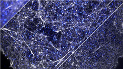 Vignette illustrant cette actualité