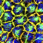 Vignette illustrant cette actualité