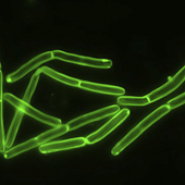 Vignette illustrant cette actualité