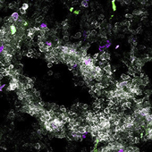 Vignette illustrant cette actualité