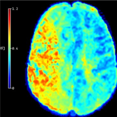 Vignette illustrant cette actualité