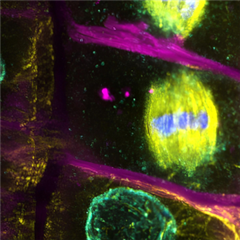 Vignette illustrant cette actualité