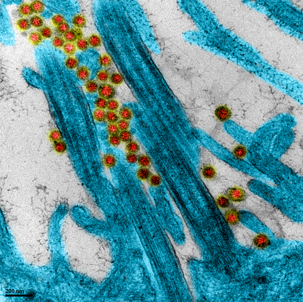 Une des toutes premières images du virus SARS-CoV-2 isolé de patients
