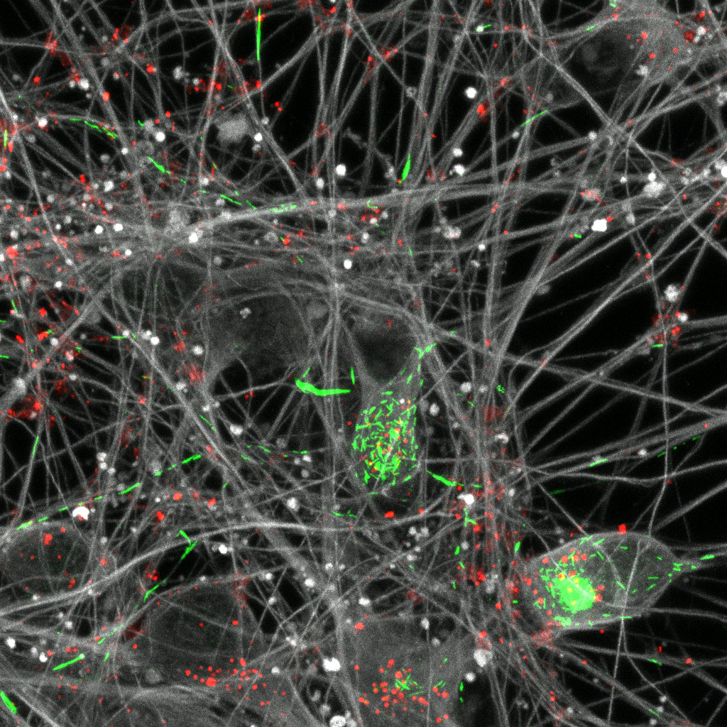 Photograph of human neurons