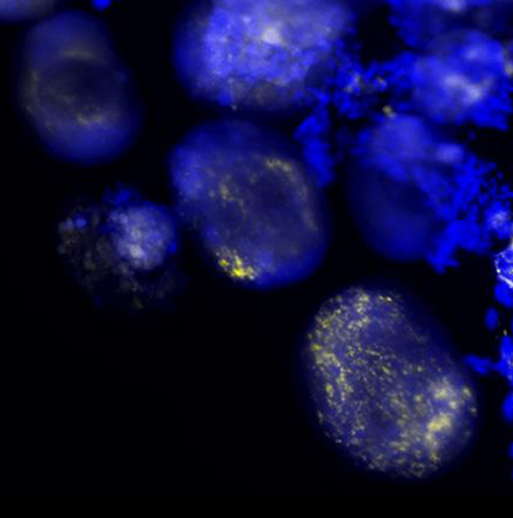 Vue microscopique d'ovocytes (en bleu) de la tique molle Ornithodoros moubata. La présence de Francisella symbiotiques (en jaune) est ici mise en évidence dans les ovocytes par une hybridation in situ en fluorescence.