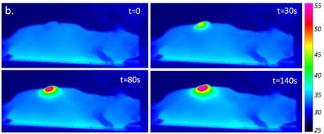 Images infrarouges d'une souris anesthésiée lorsque sa tumeur, injectée de nanotubes, est exposée à un laser. L'échelle de droite représente la température en surface.