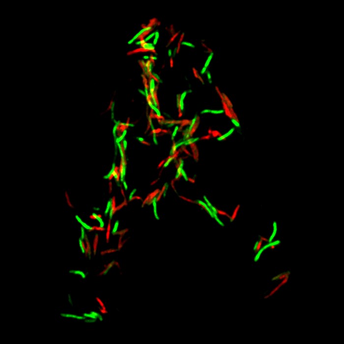 bactéries colorées par des marqueurs fluorescents, vues au microscope