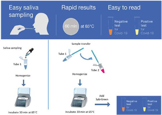 suspensie component Overtollig Promising initial results for a COVID-19 diagnostic test in saliva | CNRS