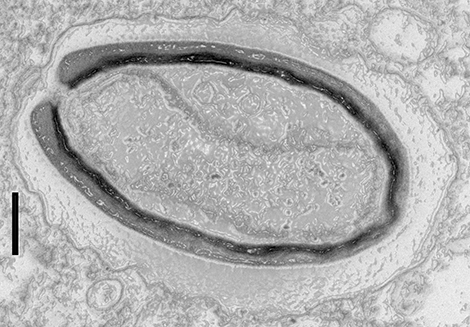 Pandoravirus : giant viruses invent their own genes